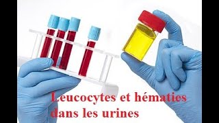 Leucocytes et hématies dans les urines