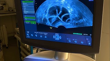 Behind the scenes of an IVF egg collection