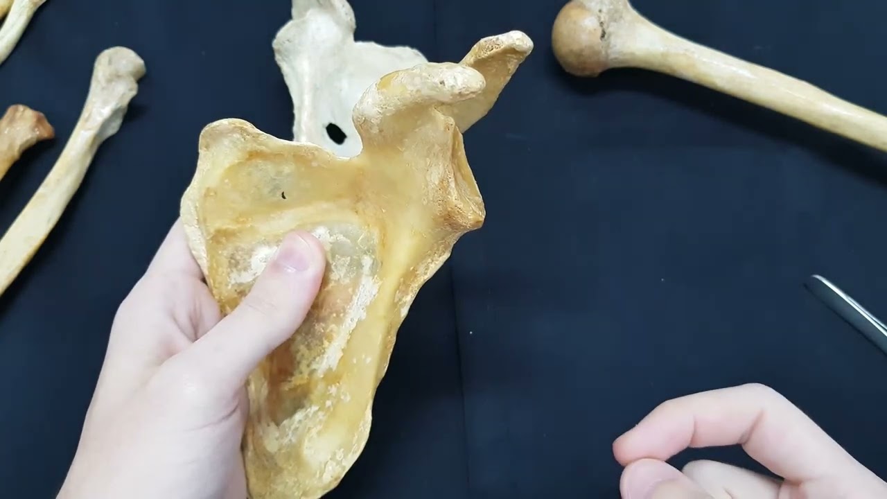 Osteologia escápula - Acidentes ósseos - MMSS
