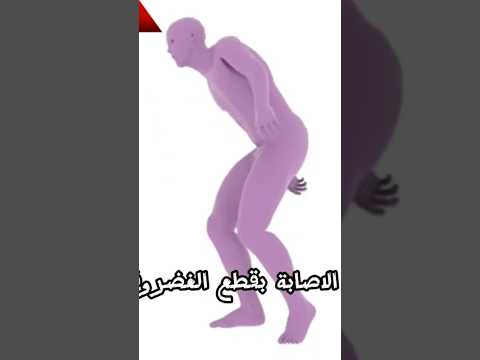 قطع غضروف الركبة