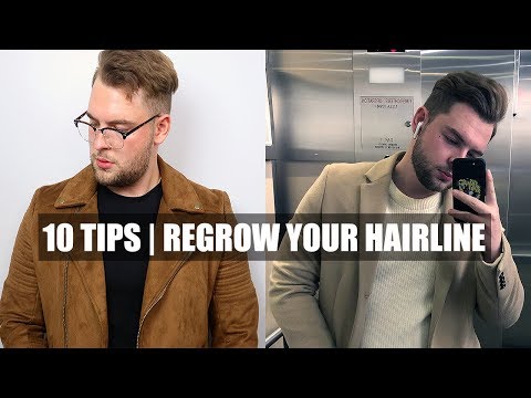 10-quick-tips|-how-to-stop-a-receding-hairline-&-receding-hairline-regrowth