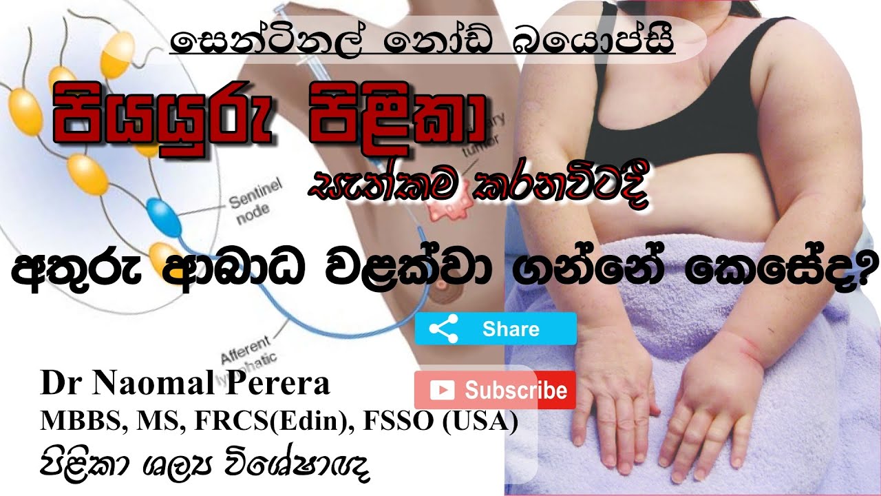 පියයුරු පිළිකා සැත්කම් කරනවිටදී අතුරු ආබාධ වලක්වා ගන්නේ කෙසේද? Know about breast cancer surgery