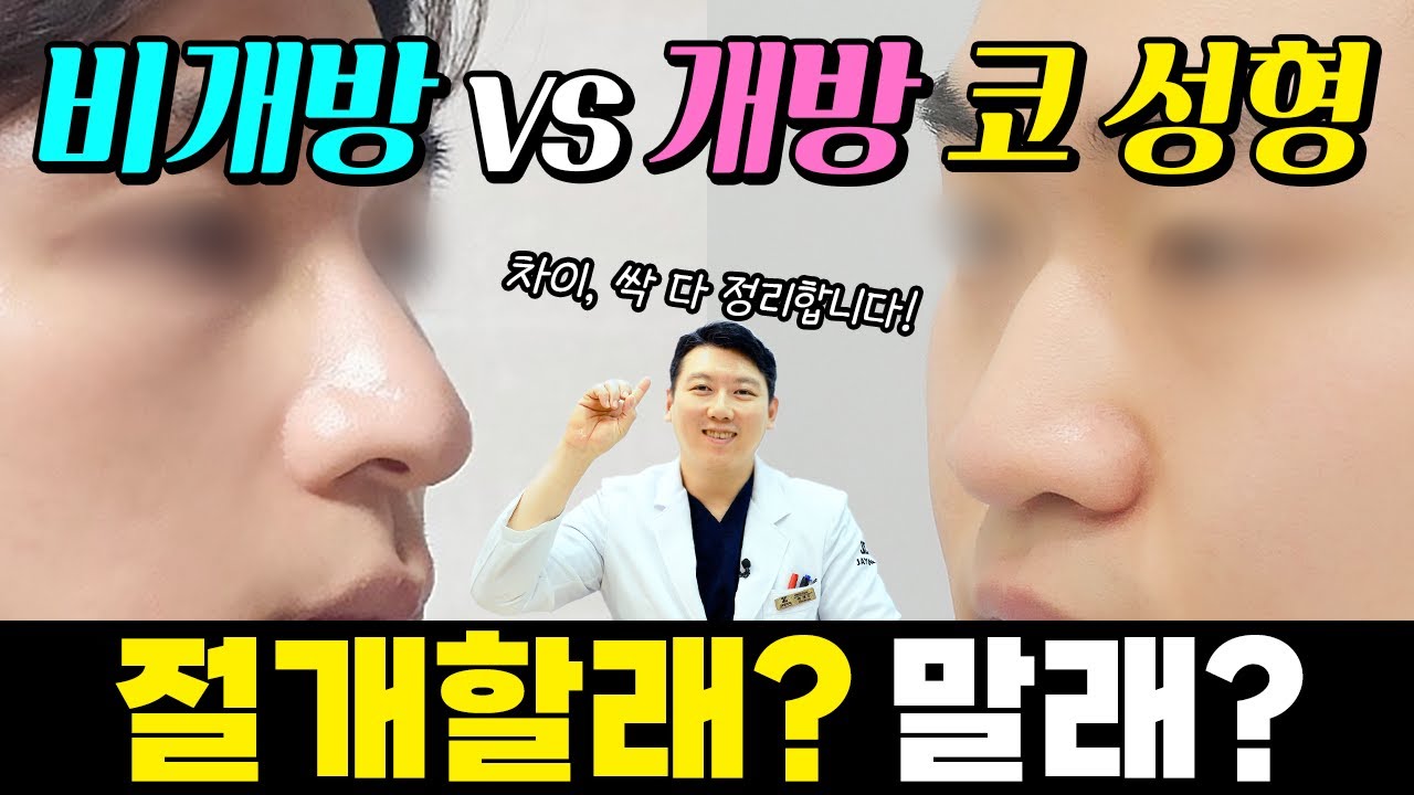 [Bệnh viện Thẩm mỹ & Da liễu Jayjun] Nâng mũi nên rạch hay không? Mở hay không mở, khác nhau thế nào?