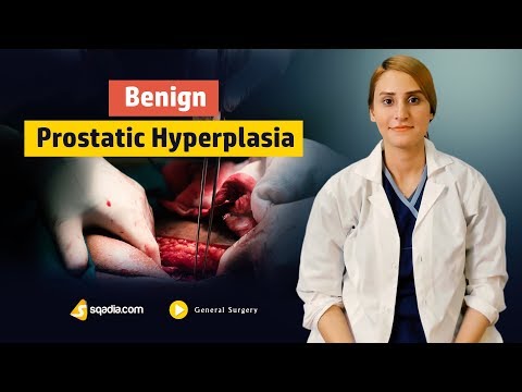 Benign Prostatic Hyperplasia | Surgery Lectures | Medical Online | V-Learning | sqadia.com