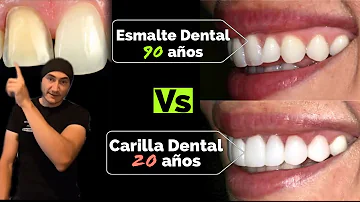 ¿Cómo se puede recuperar el esmalte de los dientes?