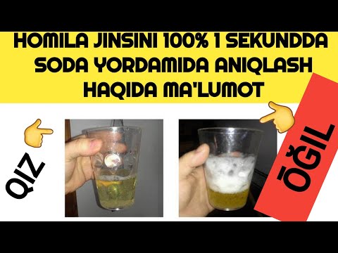 HOMILA JINSINI SODA BILAN 100%  UY SHAROITIDA ANIQLASH HAQIDA MA'LUMOT. #HOMILA JINSINI ANIQLASH