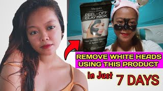 HOW TO REMOVE BLACK HEADS & WHITE HEADS USING 1 PRODUCT | + Honest Review and Feedback | Jing Jane