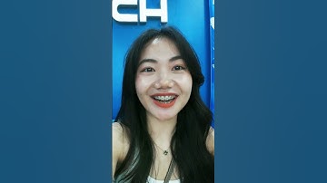 "Lột xác" nhờ niềng răng - khách hàng Lê Thị Liên | Lạc Việt Intech Niềng Răng #shorts