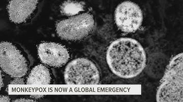 WHO declares monkeypox global health emergency as cases surge in 75 countries