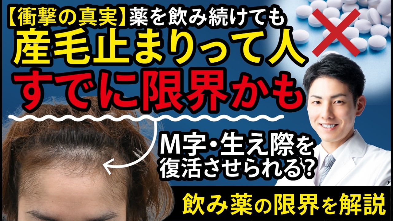 【M字の限界】飲み薬では生えない生え際を「確実に」復活させる唯一の方法と5月にやるべき理由