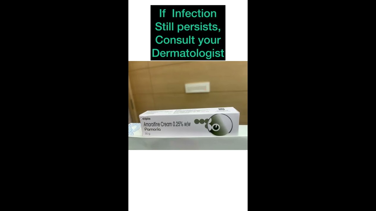 Best Creams For Fungal Infection Skin Fungus Treatment Dr Ashima Goel MD Ringworm Tinea