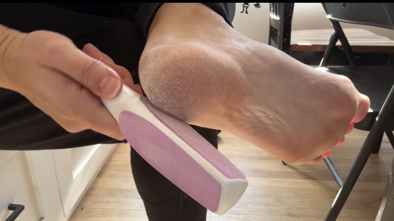 My old callus remover could never!