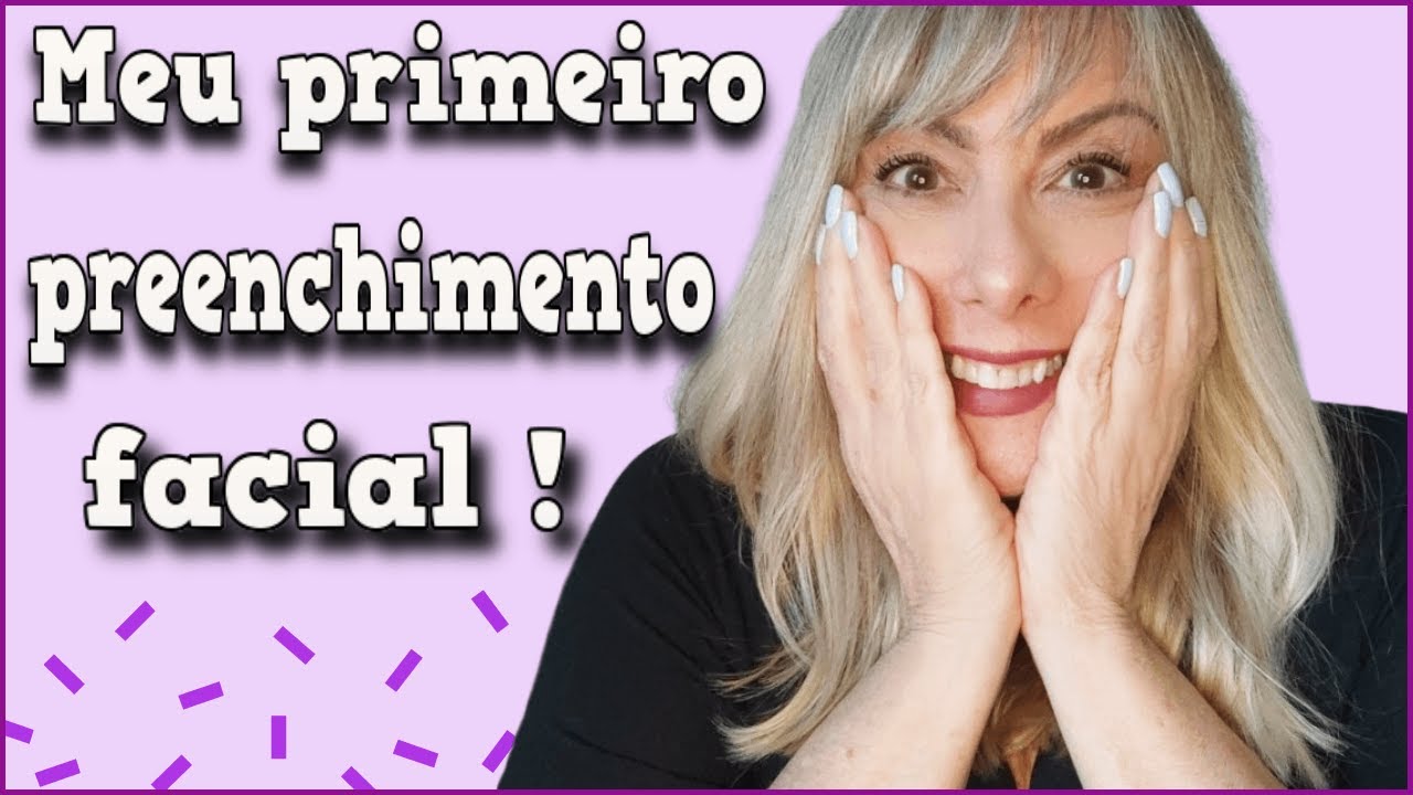😁FIZ PREENCHIMENTO COM ÁCIDO HIALURÔNICO NO ROSTO ANTES E DEPOIS