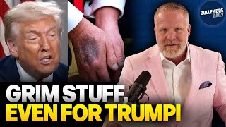 Donald Trump Announces HE HOPES HE DOESN'T DIE IN 2026!!!