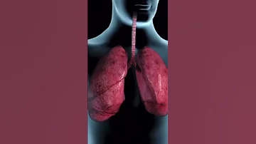 Tuberculosis TB Symptoms Symptoms Tb 
