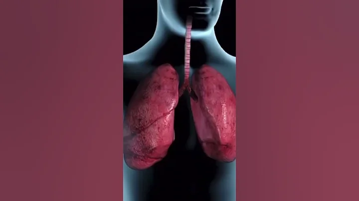 Tuberculosis (TB) Symptoms #symptoms #tb - DayDayNews
