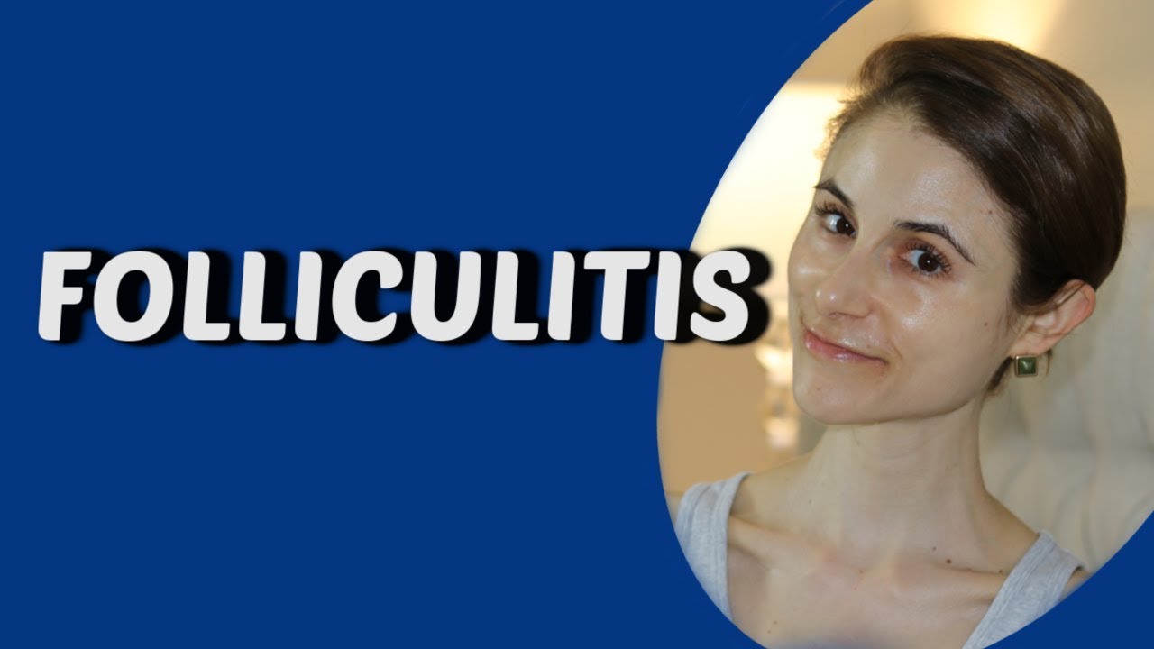 WHAT IS CAUSING MY FOLLICULITIS? Q&A WITH DERMATOLOGIST DR DRAY