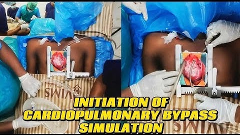 Initiation of CPB Simulation | SAHS, Salem | Department of Perfusion Technology #cpb #simulation