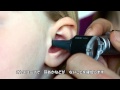 オーティコン小児補聴器 センセイプロのイージーRECD（実耳測定）とは