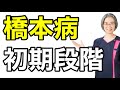 【橋本病 症状】初期段階は?!