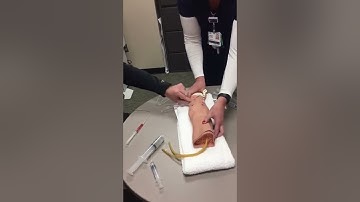 Ictal Spect Side By Side