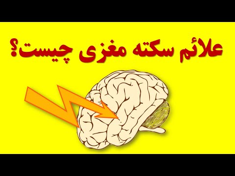 علائم سکته مغزی چیست؟