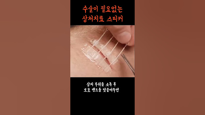 봉합 스티커 신개발 상처 치료제 #제품리뷰