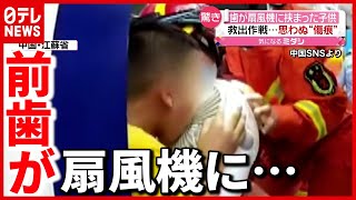 【取れない！】子供の前歯が扇風機に挟まる…救出作戦  中国