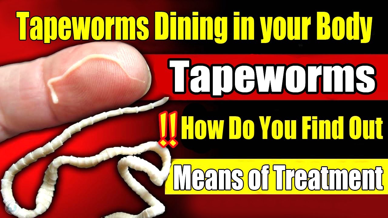 Signs That You Have Tapeworms Living In Your Body how Do You Find Out