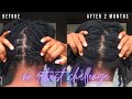 NOT RETWISTING LOCS FOR 2 MONTHS | THOUGHTS | LOC UPDATE | LOC JOURNEY