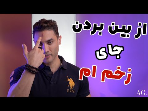 تصویری: 4 راه برای از بین بردن زخم و ضربات تاتو