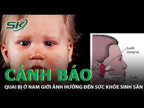 Bệnh Quai Bị Có Được Quan Hệ Không - Quai Bị Ở Nam Giới Ảnh Hưởng Đến Sức Khỏe Sinh Sản | SKĐS