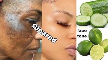 Diy Cucumber Pimple Treatments | Creative Explaned 