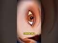 How Ectropion Repair surgery Fixes NA YDroopy Eyelids Protects Vision(3D Animation)#ectropionrepair