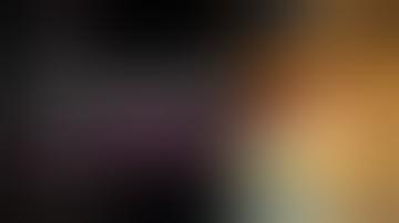 Toegang tot het onderste baarmoedersegment tijdens een keizersnede met dichte verklevingen | Dr. ...