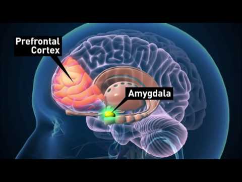 Vídeo: O que é síndrome orbitofrontal?