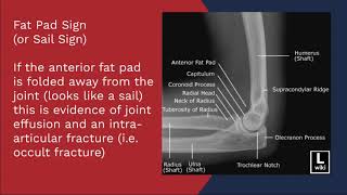 X-ray Positioning Evaluation - Lateral Elbow Basic Elbow X Ray Evaluation