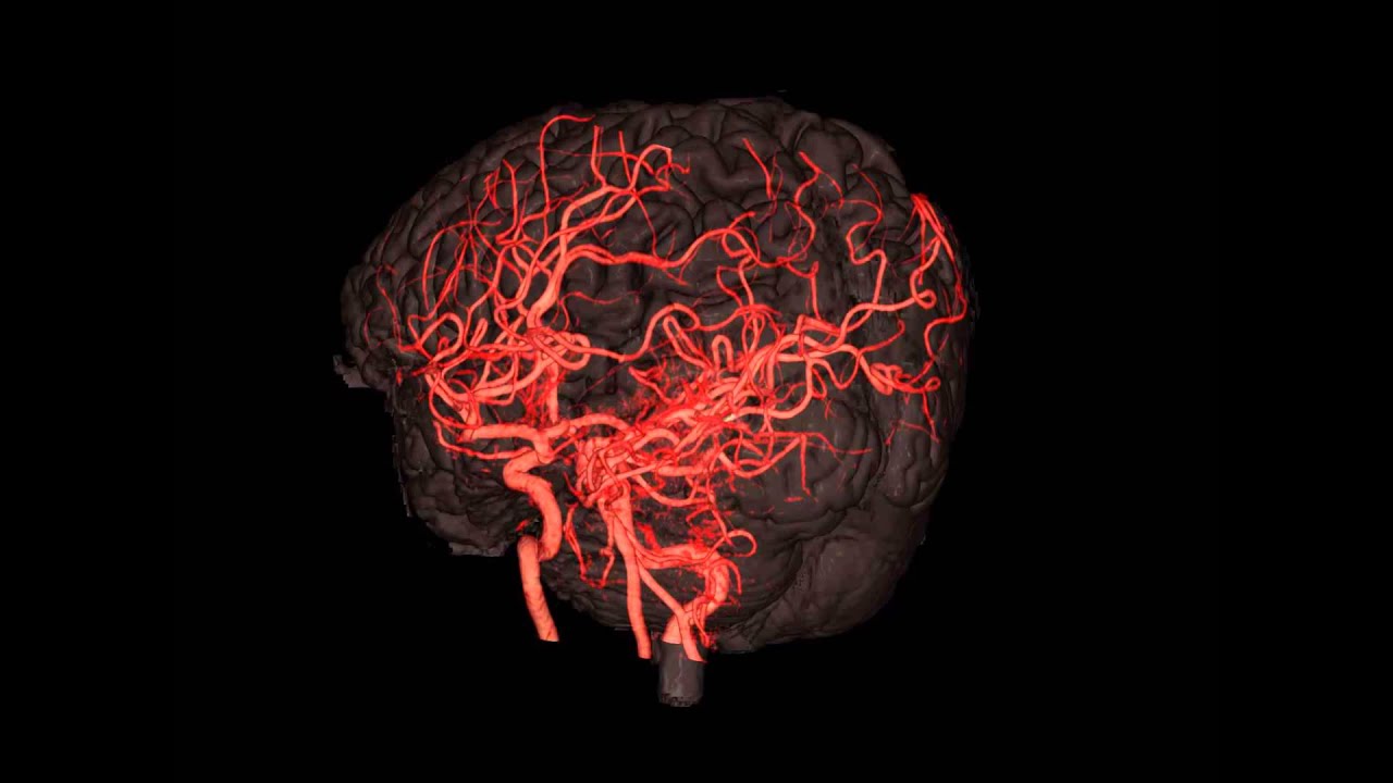 脳血管を360度横回転で観察 Youtube