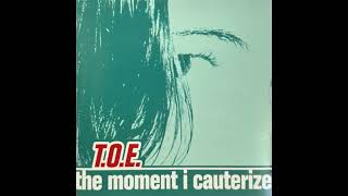 Watch Toe Cauterize video