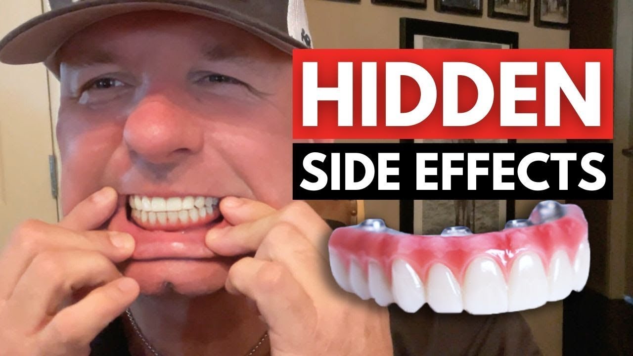 Outline Video No one told me dental implants affect your immune system!?