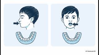 Mouth Breathing Children Mansfield TX: Guided Jaw Development Insights with Dr. Jiyoung Jung