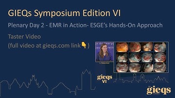 Plenary Day 2 - EMR in Action- ESGE’s Hands-On Approach (Taster Video)