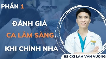 Đánh Giá Ca Lâm Sàng Khi Chỉnh Nha P1