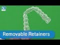 Removable retainers, which one