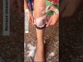 Stop! shaving it is the easiest way to remove facial body and public hair without pain#hairremovalir
