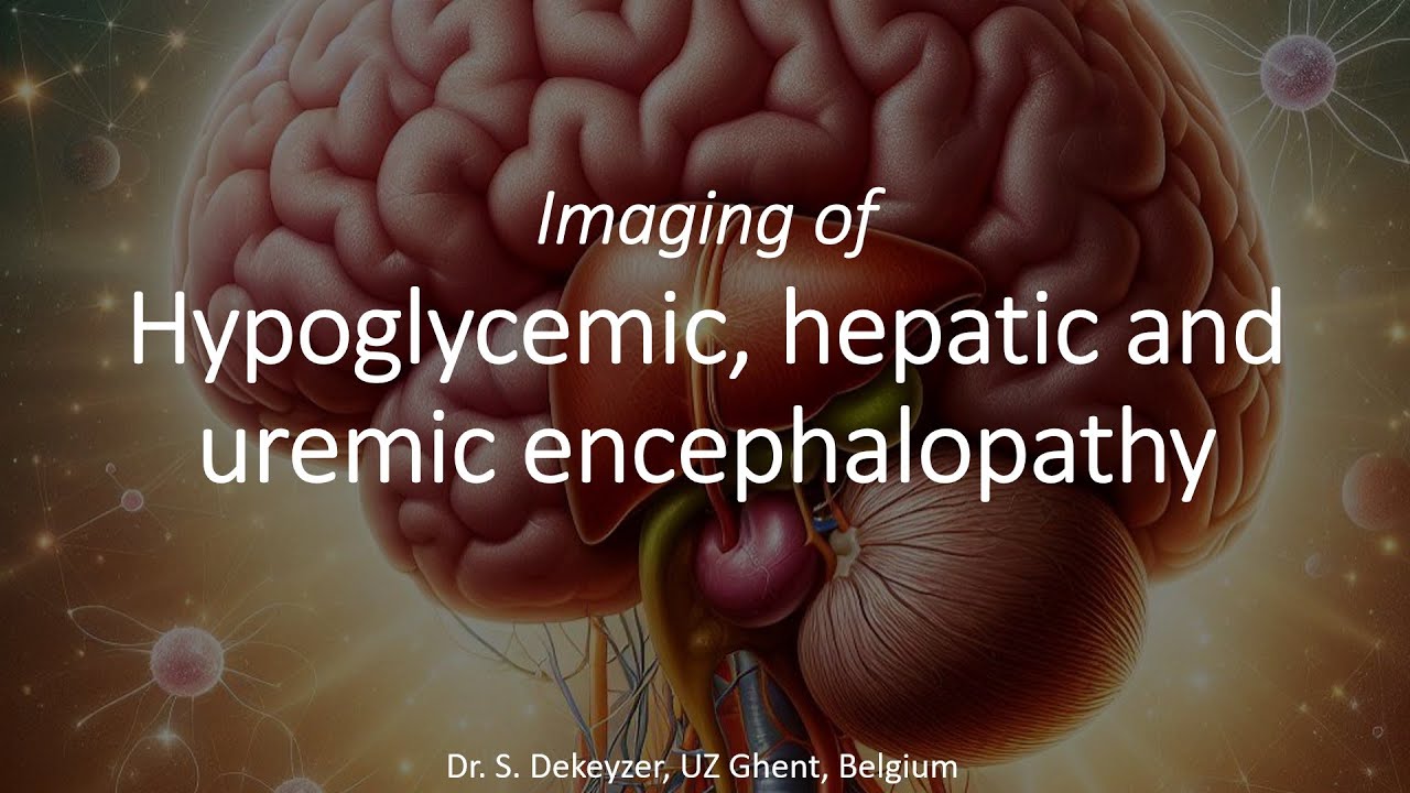 imaging-of-toxic-metabolic-brain-disorders-hypoglycemic-hepatic