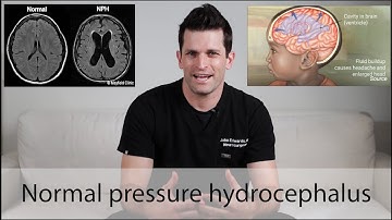 Normal Pressure Hydrocephalus \\ everything you need to know