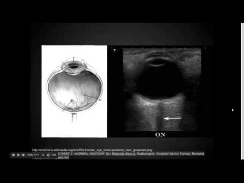 Video: Ecografie Pentru Ochi și Orbite: Scop, Procedură și Riscuri