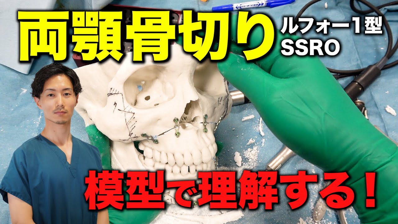 Fully understand bimaxillary osteotomy with a model! How the upper
