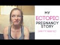 My Ectopic Pregnancy Story